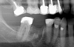 bridge-xray (1)
